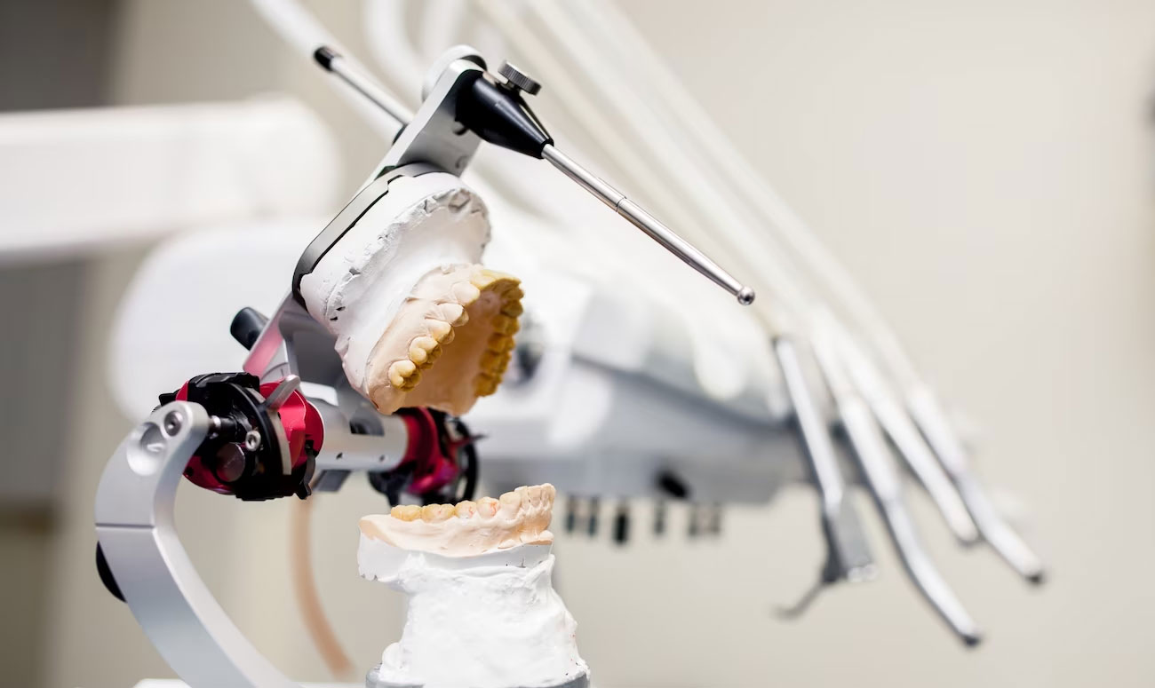 Revolutionizing Implant Dentistry: The Puche Approach - Puche Dental Lab