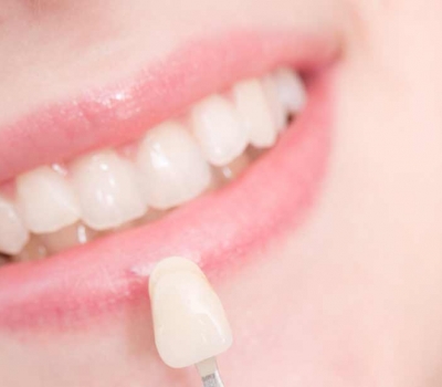 Transform Your Teeth with Porcelain Dental Veneers - Microbits