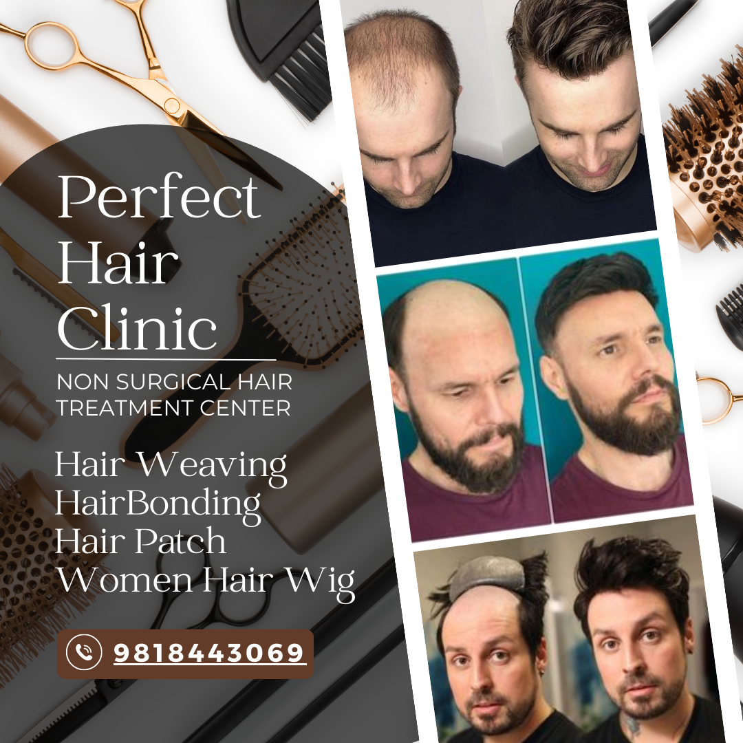 Best Hair Patch Service in South Delhi| Hair Loss Solution in Delhi