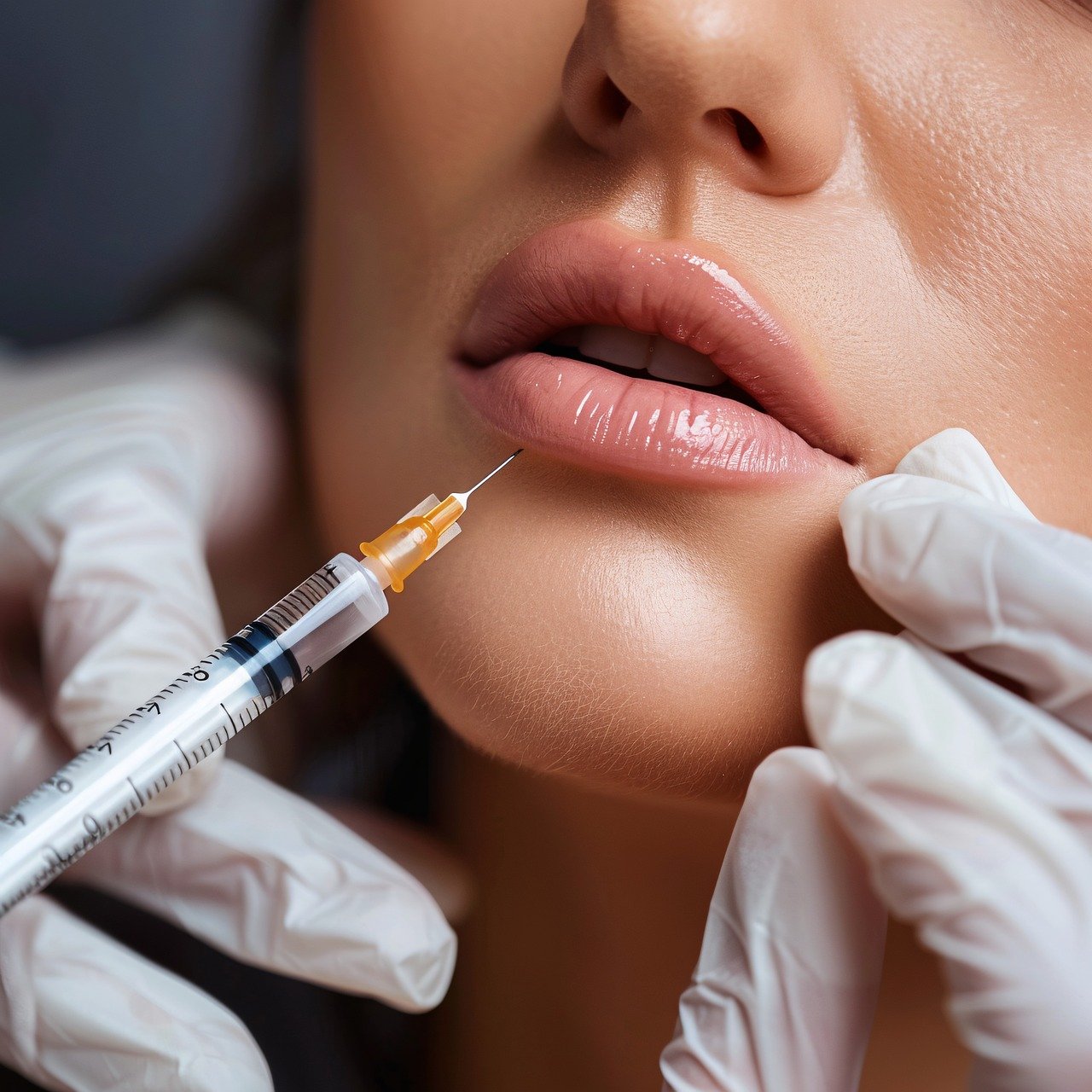 What to Expect From a Dermal Filler Treatment Procedure?