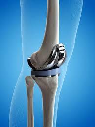 Discover the Best Doctor in Delhi for Orthopedic Care: Dr. Khera’s Wellness Clinic - Expert Joint Replacement Surgeon in Delhi – @drkheras on Tumblr