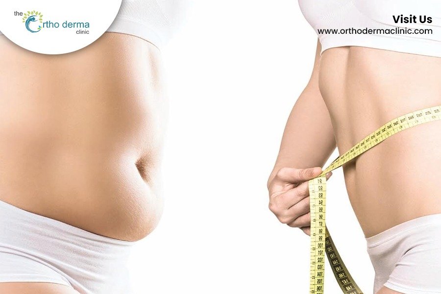 Body Sculpting Treatments in Punjab