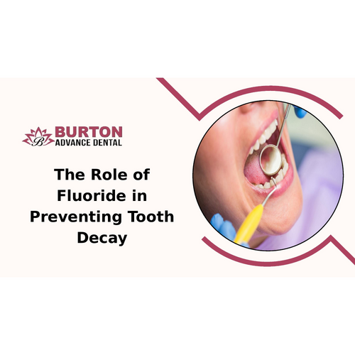 The Role of Fluoride in Preventing Tooth Decay