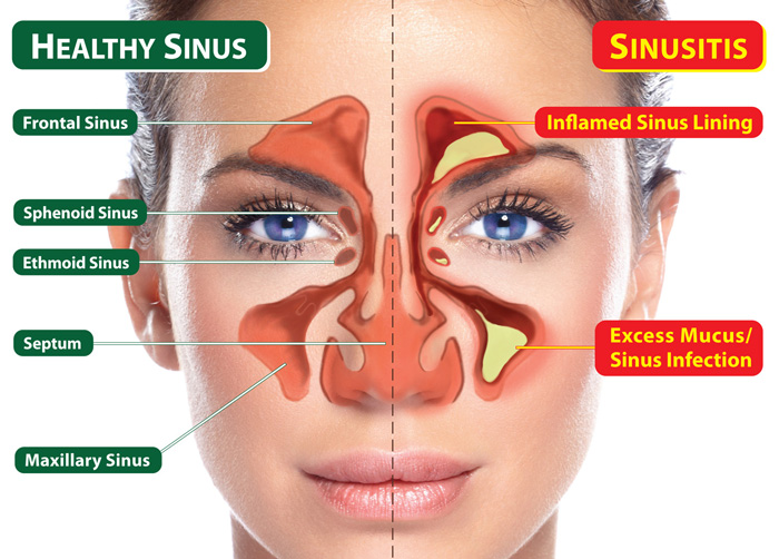 Top ENT Specialist Doctor | Ventura Ear, Nose & Throat Clinic