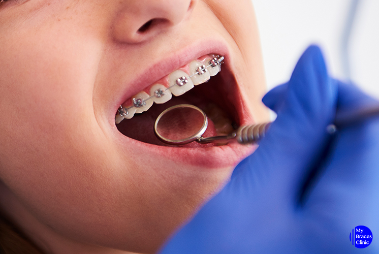 What to Expect at Your First Orthodontist Appointment – Telegraph