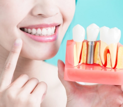 Top-notch things to notice about dental implants and procedures – Hawthorn East Dental