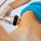 Skin Tightening Laser Melbourne: The Secret to Younger-Looking Skin