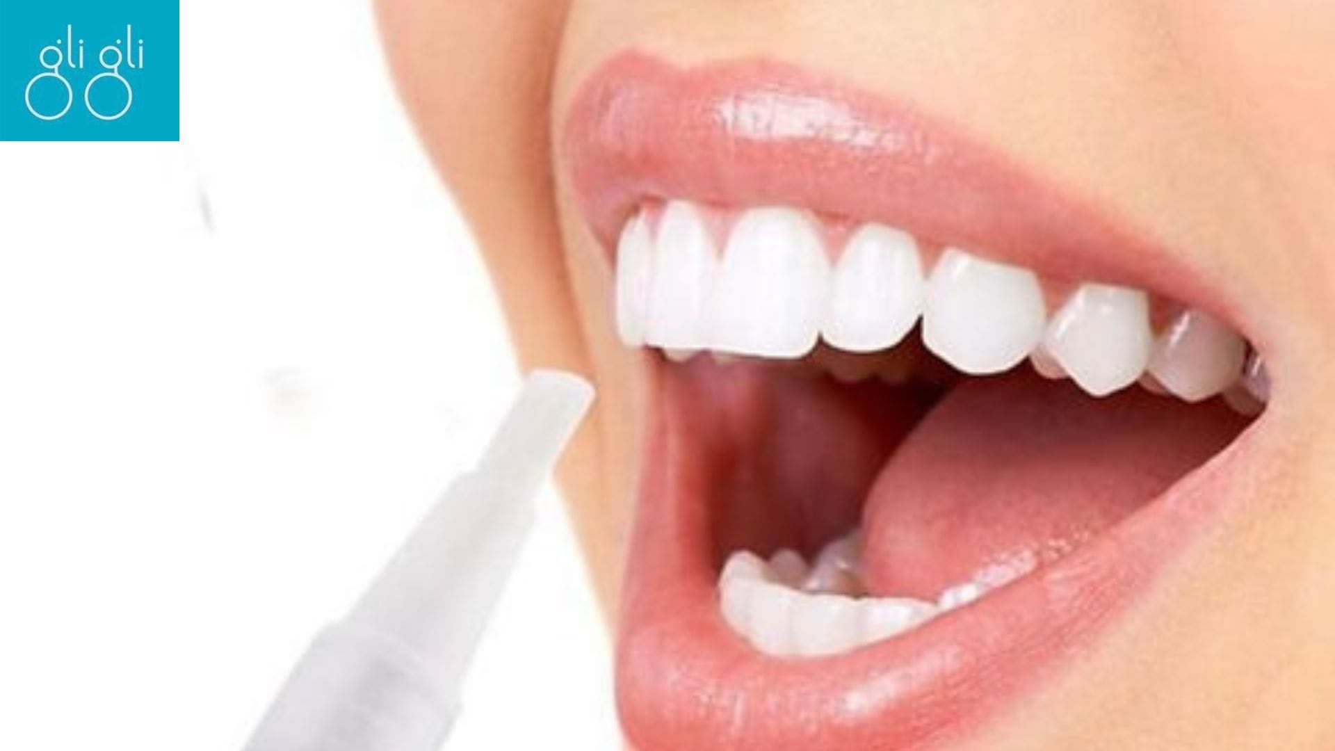 Teeth Whitening Pens: An Easy, Fast, and Economical Way to Whiten Teeth - Repur Tech