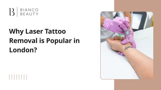 Why Laser Tattoo Removal is Popular in London? | PPT