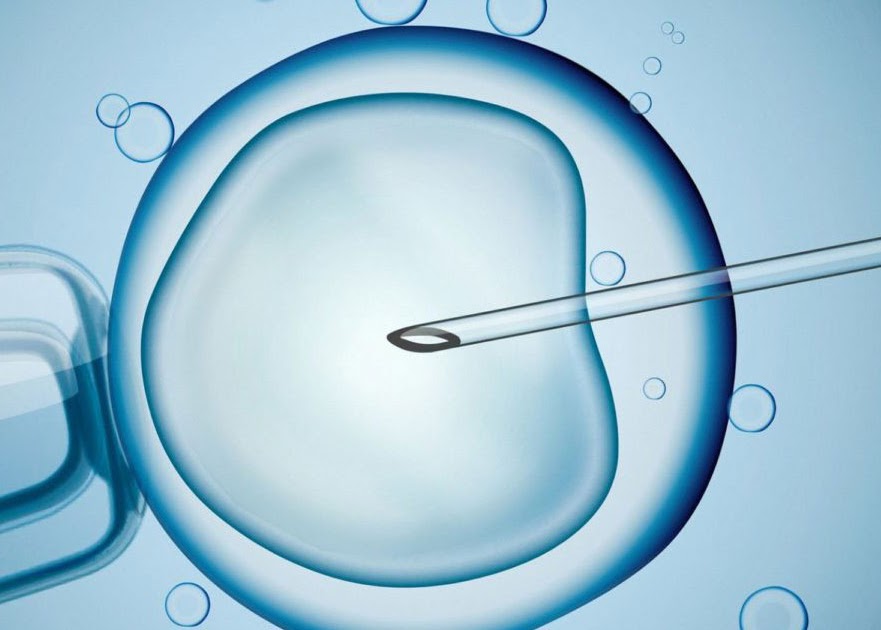 Best IUI Specialist in Delhi – Expert Fertility Care at Aarogya IVF Centre