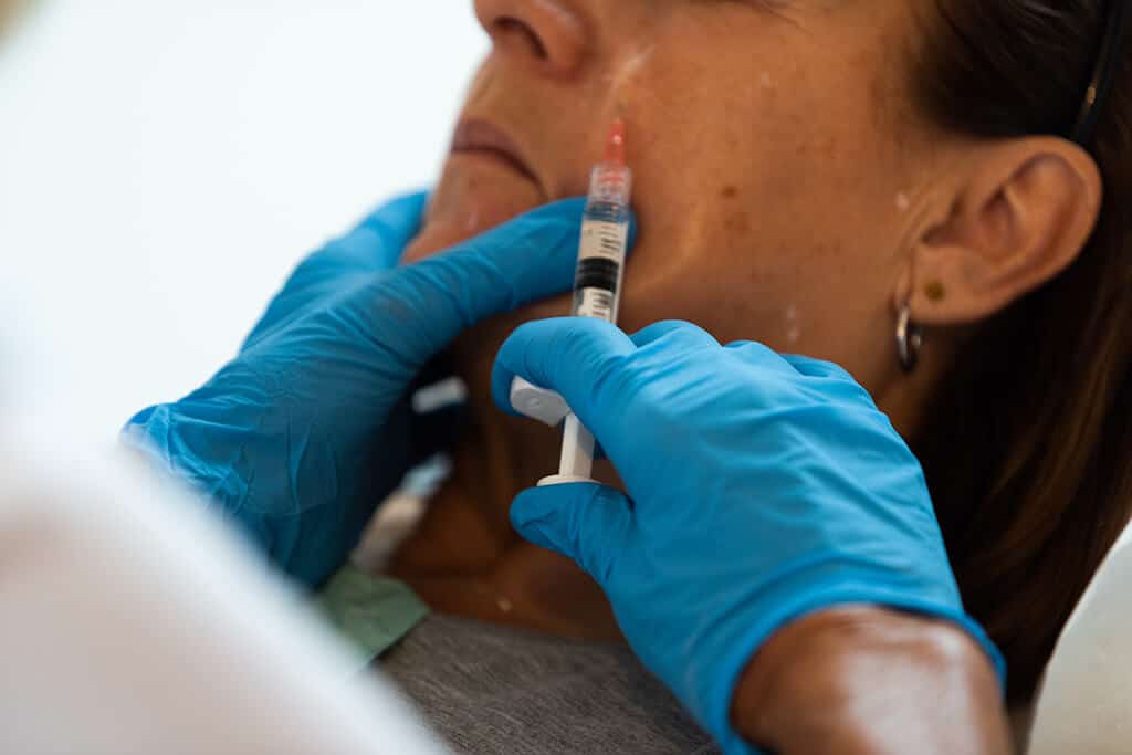 Dermal Fillers in Sheffield, Skin Tightening - Elm Skin Clinics