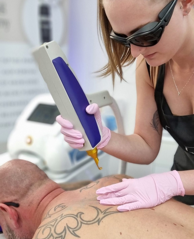 Tattoo Removal Before and After: What to Expect as a Practitioner?: ext_6582908 — LiveJournal