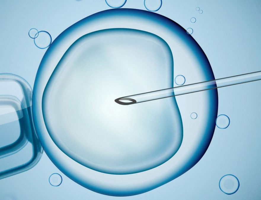 Best IUI Clinic in East Delhi – Aarogya IVF Centre - Easyfie