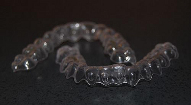 Invisalign for Teens: Is It Worth Investing In? - Local Dentist Member Article By Holistic Dental Melbourne CBD