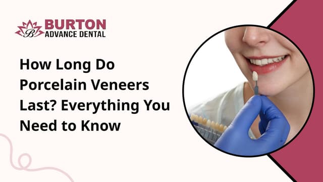 How Long Do Porcelain Veneers Last Everything You Need to Know | PPT