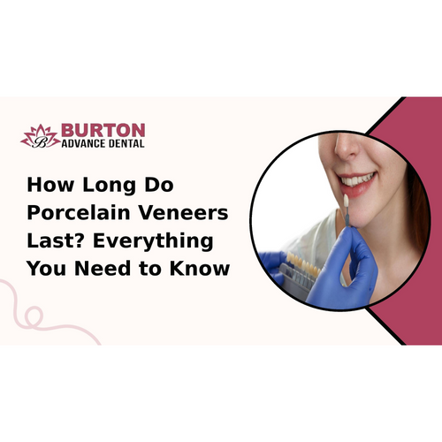 How Long Do Porcelain Veneers Last? Everything You Need to Know