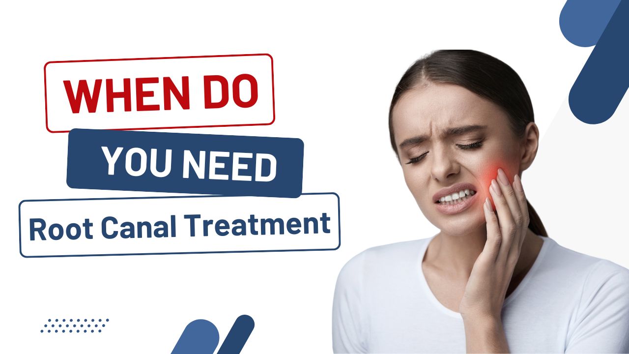 When Do You Need Root Canal Treatment in Kolkata?