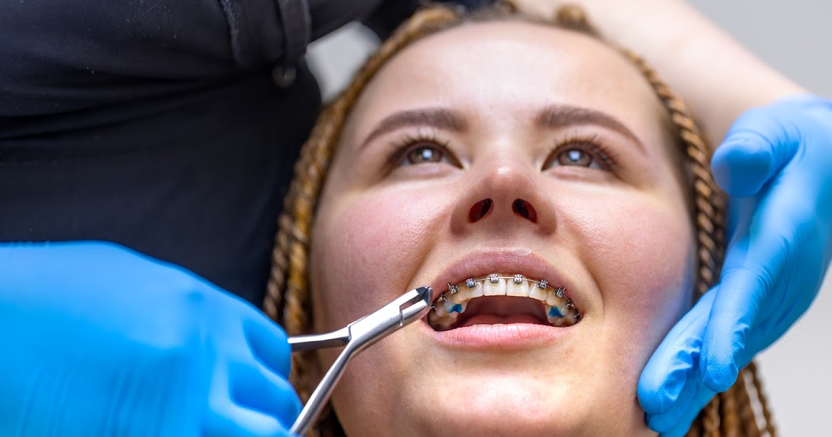 Top 5 Reasons to Visit the Best Orthodontist in Baga Goa