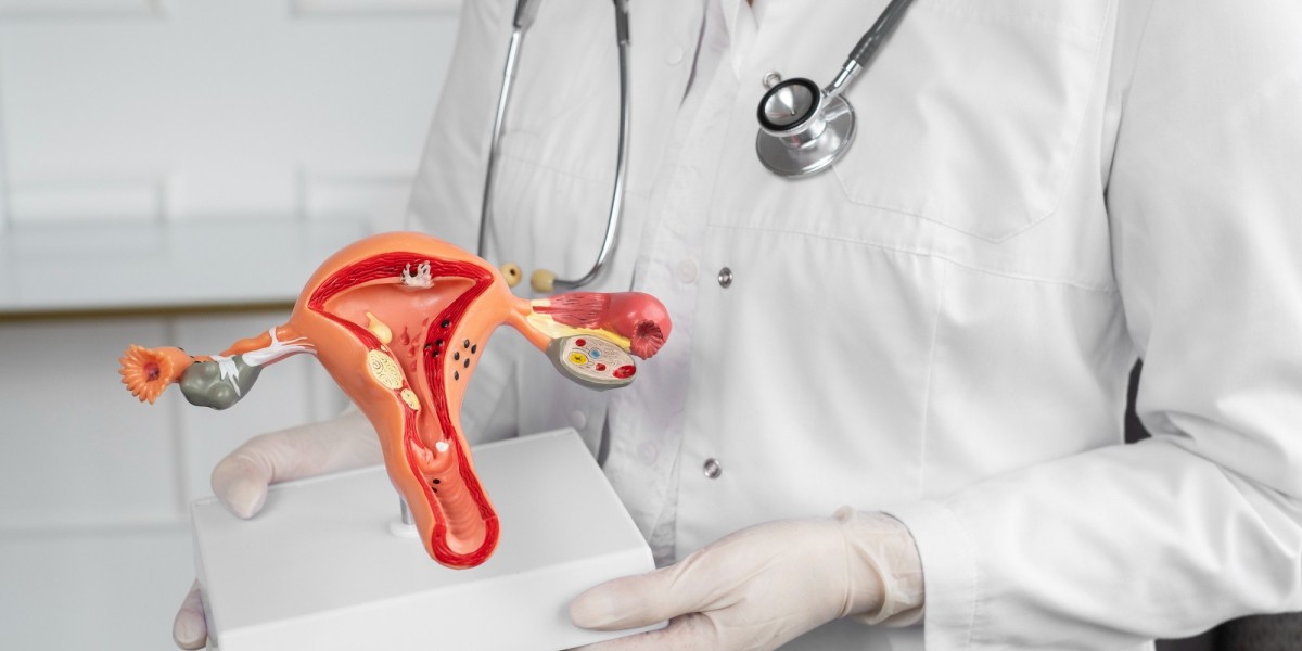 Comprehensive Ovarian CYST Treatment In South Delhi: Restoring Women's Health with Expertise