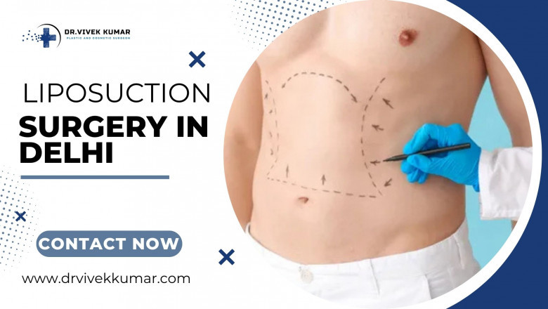 Best Liposuction Surgery in Delhi: Get the Body You Desire with Expert Care | Public Data Feed 24x7
