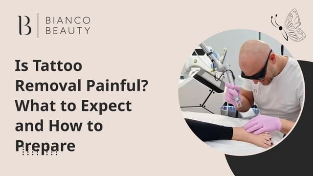 Is Tattoo Removal Painful What to Expect and How to Prepare | PPTX