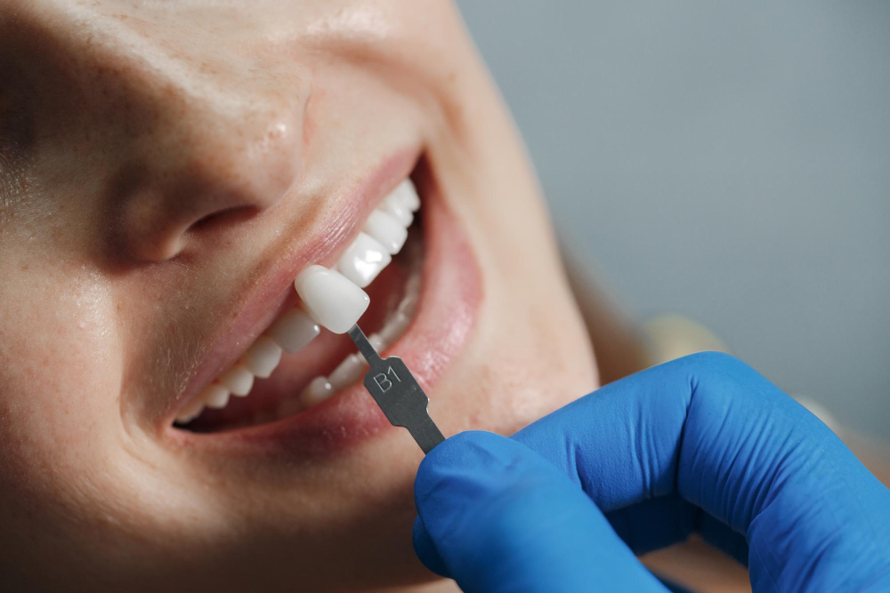 Dentures vs. Implants: Which Option is Best for You?